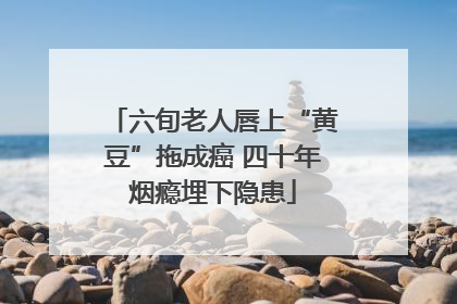 六旬老人唇上“黄豆”拖成癌 四十年烟瘾埋下隐患
